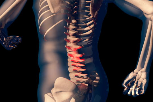 Spinal Adjustment Therapy